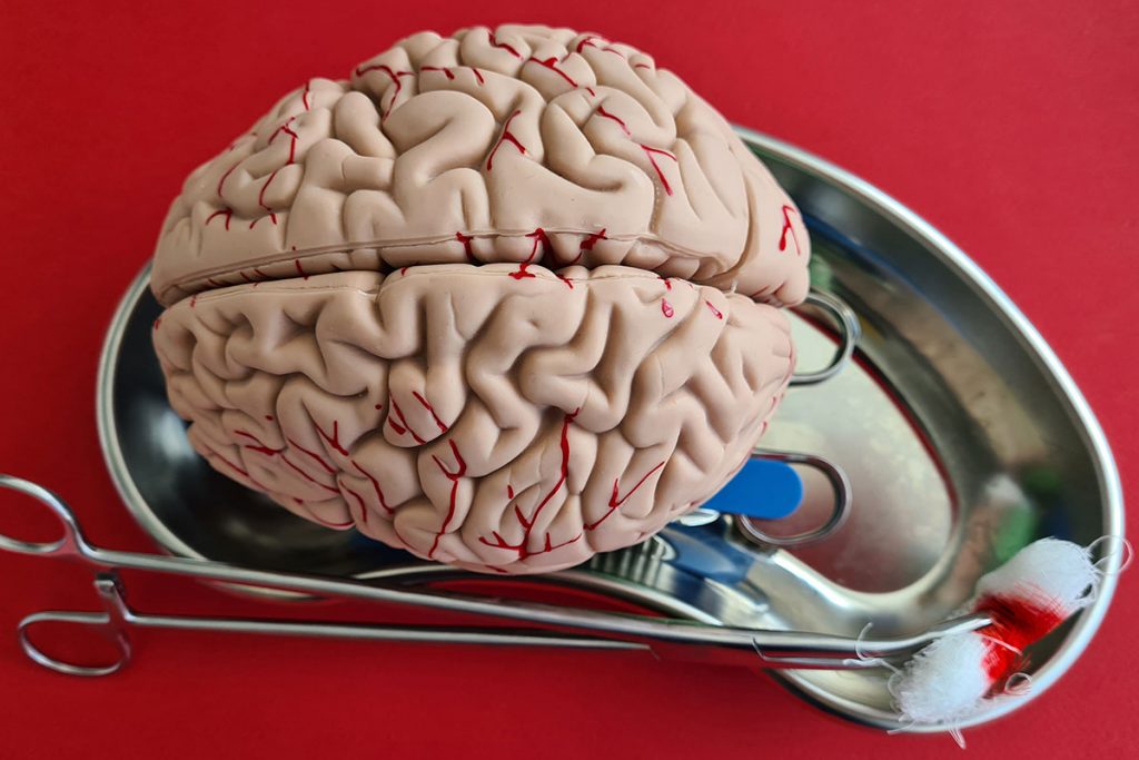 O Ministério da Saúde mostra que no Brasil, cerca de 1,2 milhões de pessoas possuem Alzheimer e que são detectados por ano 100 mil novos casos. Mas quais os cuidados que devemos ter para cuidar de alguém com Alzheimer?